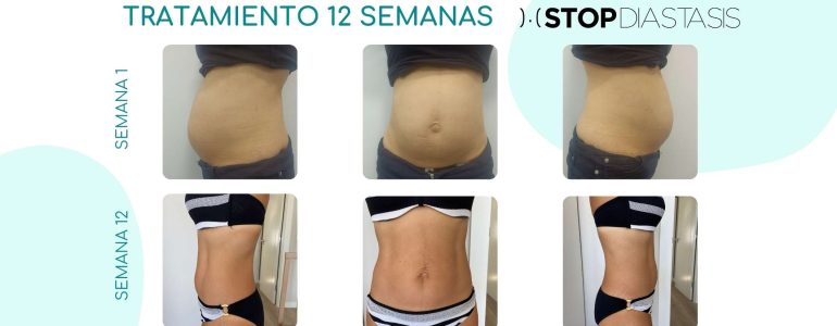 TRATAMIENTO-12-SEMANAS-4